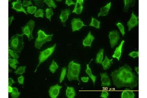 Immunofluorescence of monoclonal antibody to PARD6B on HeLa cell. (PARD6B antibody  (AA 1-372))