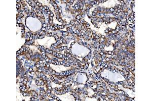 IHC analysis of Paxillin/PXN using anti-Paxillin/PXN antibody (ABIN7602636). (Paxillin antibody  (AA 9-570))