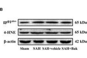 The effect of Bak on the oxidative stress 24 h after SAH. (beta Actin antibody  (AA 1-375))