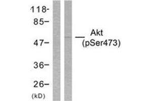 Western blot analysis of extracts from HeLa cells treated with heat shock, using Akt (Phospho-Ser473) Antibody. (AKT1 antibody  (pSer473))