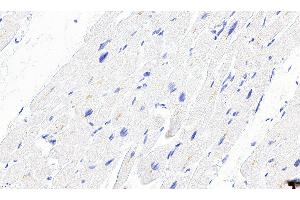 Immunohistochemistry (IHC) image for anti-Desmin (DES) (C-Term) antibody (ABIN334386)