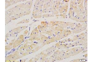 Formalin-fixed and paraffin embedded rat heart labeled with Anti-factor V Polyclonal Antibody, Unconjugated  at 1:200 followed by conjugation to the secondary antibody and DAB staining. (Factor 5 (AA 301-400) antibody)