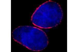 anti-Nucleoporin 153kDa (NUP153) (AA 50-100) antibody