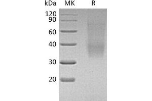 Western Blotting (WB) image for SLAM Family Member 9 (SLAMF9) protein (His tag) (ABIN7320650) (SLAMF9 Protein (His tag))