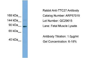 WB Suggested Anti-TTC27  Antibody Titration: 0. (TTC27 antibody  (N-Term))