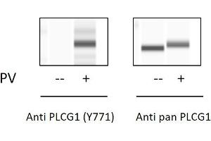 Pervanadate (PV) Stimulation of Jurkat Cell Line (Phospholipase C gamma 1 ELISA Kit)