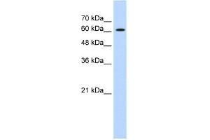 WB Suggested Anti-ZIC2 Antibody Titration:  0. (ZIC2 antibody  (C-Term))