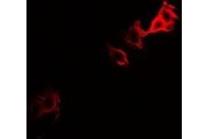 Immunofluorescent analysis of PGM1 staining in U2OS cells. (Phosphoglucomutase 1 antibody)