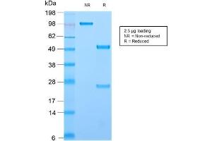 SDS-PAGE Analysis Purified CD44 Rabbit Recombinant Monoclonal Antibody (HCAM/2875R). (Recombinant CD44 antibody)