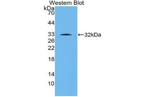 Western blot analysis of the recombinant protein. (PAI1 antibody  (AA 141-389))