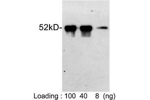 Loading: S-tag fusion protein expressed in E. (S-Tag antibody)