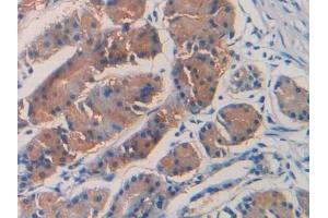 Detection of SEPT5 in Human Stomach Tissue using Polyclonal Antibody to Septin 5 (SEPT5)