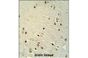 Immunohistochemistry (Paraffin-embedded Sections) (IHC (p)) image for anti-X-Ray Repair Complementing Defective Repair in Chinese Hamster Cells 6 (XRCC6) (AA 228-254) antibody (ABIN651281)