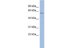 WB Suggested Anti-ZNF502 Antibody Titration:  0.