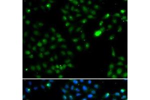Immunofluorescence analysis of HeLa cells using FKBP3 Polyclonal Antibody (FKBP3 antibody)