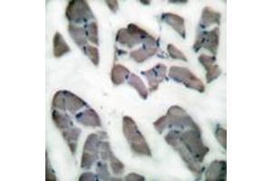 Immunohistochemistry analysis of paraffin-embedded human skeletal muscle tissue, using Desmin Antibody. (Desmin antibody  (AA 421-470))