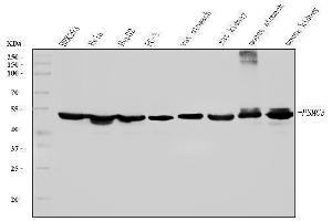 Western blot analysis of TBP-1/PSMC3 using anti-TBP-1/PSMC3 antibody (ABIN7599392).