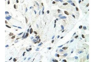 Immunohistochemistry (IHC) image for anti-Splicing Factor Proline/glutamine-Ric (SFPQ) antibody (ABIN1874752)