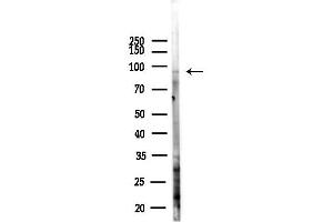 anti-Connector Enhancer of Kinase Suppressor of Ras 1 (CNKSR1) (Internal Region) antibody