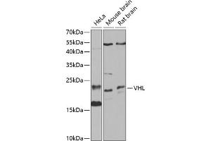 Western blot analysis of extracts of various cell lines, using VHL antibody (ABIN3020967, ABIN3020968, ABIN3020969 and ABIN6213828) at 1:1000 dilution. (VHL antibody  (AA 1-172))