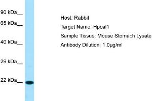 WB Suggested Anti-Hpcal1 Antibody   Titration: 1. (HPCAL1 antibody  (C-Term))
