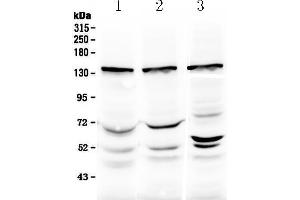 Western blot analysis of Exportin-5 using anti-Exportin-5 antibody . (XPO5 antibody  (N-Term))
