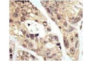 Immunohistochemistry (IHC) image for anti-Small Ubiquitin Related Modifier Protein 1 (SUMO1) (AA 1-30) antibody (ABIN3032644)