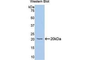 Detection of Recombinant GALC, Human using Polyclonal Antibody to Galactosylceramidase (GALC) (GALC antibody  (AA 375-535))