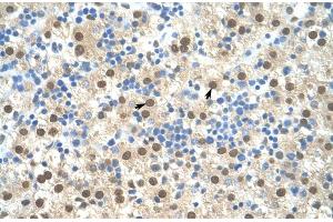 Human Liver (RIPK3 antibody  (N-Term))
