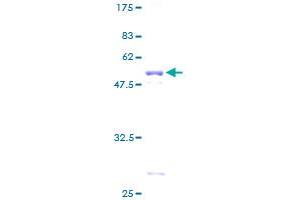 PPP1R1A Protein (AA 1-171) (GST tag)