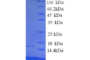SDS-PAGE (SDS) image for Eukaryotic Translation Initiation Factor 4E Binding Protein 2 (EIF4EBP2) (AA 1-120), (full length) protein (His tag) (ABIN5713422)