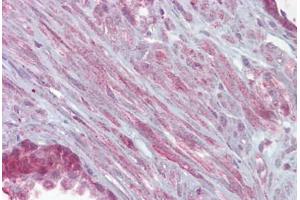 Anti-KCNMA1 antibody IHC staining of human prostate. (KCNMA1 antibody  (AA 1080-1129))