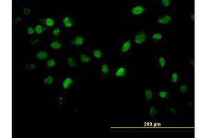 Immunofluorescence of monoclonal antibody to AKT2 on HeLa cell. (AKT2 antibody  (AA 100-189))