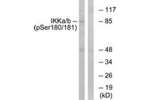 Western blot analysis of extracts from HepG2 cells treated with TNF 20ng/ml 5', using IKK-alpha/beta (Phospho-Ser180/181) Antibody. (IKK-alpha /IKK-beta antibody  (pSer180))