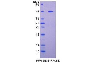 SDS-PAGE (SDS) image for Lacritin (LACRT) (AA 20-138) protein (His tag,GST tag) (ABIN1981093) (Lacritin Protein (LACRT) (AA 20-138) (His tag,GST tag))