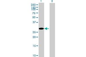Western Blot analysis of CCS expression in transfected 293T cell line by CCS MaxPab polyclonal antibody. (Superoxide dismutase copper chaperone antibody  (AA 1-274))