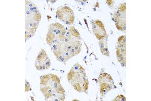 Immunohistochemistry of paraffin-embedded human gastric using MYLK antibody at dilution of 1:100 (x40 lens). (MYLK antibody)