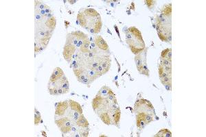 Immunohistochemistry of paraffin-embedded human gastric using MYLK antibody at dilution of 1:100 (x40 lens).