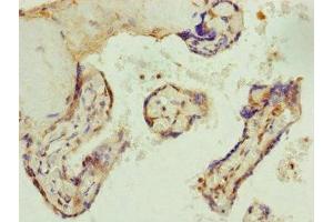 Immunohistochemistry of paraffin-embedded human placenta tissue using ABIN7144350 at dilution of 1:100 (AP1M1 antibody  (AA 1-160))