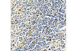 IHC analysis of MPO using anti-MPO antibody (ABIN7602030). (Myeloperoxidase antibody  (AA 556-697))