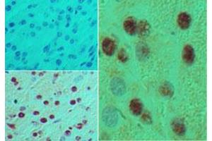 HB9 Immunohistochemistry. (MNX1 antibody)