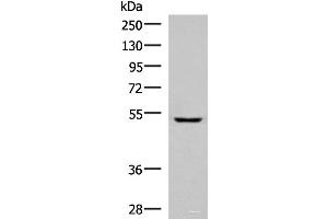 Western blot analysis of Human fetal liver tissue lysate using PISD Polyclonal Antibody at dilution of 1:600 (PISD antibody)