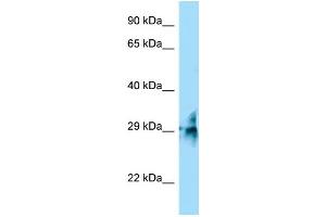 WB Suggested Anti-TMUB2 Antibody Titration: 1. (TMUB2 antibody  (C-Term))