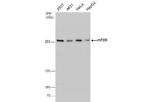 WB Image mTOR antibody detects mTOR protein by western blot analysis.