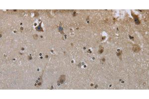 Immunohistochemistry of paraffin-embedded Human brain using GYS1 Polyclonal Antibody at dilution of 1:50 (Glycogen Synthase 1 antibody)