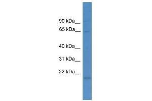 Western Blot showing LTA4H antibody used at a concentration of 1-2 ug/ml to detect its target protein. (LTA4H antibody  (N-Term))