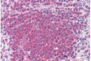 Human Spleen (formalin-fixed, paraffin-embedded) stained with CHEK2 antibody ABIN213892 at 10 ug/ml followed by biotinylated anti-mouse IgG secondary antibody ABIN481714, alkaline phosphatase-streptavidin and chromogen. (CHEK2 antibody)