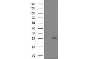 Western Blotting (WB) image for anti-Adenylate Kinase 3 (AK3) antibody (ABIN1496519) (Adenylate Kinase 3 antibody)