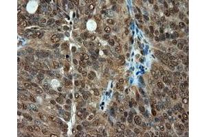 Immunohistochemical staining of paraffin-embedded colon tissue using anti-PSMC3 mouse monoclonal antibody.