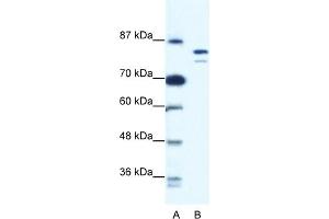 WB Suggested Anti-MCM8 Antibody Titration:  0. (MCM8 antibody  (N-Term))